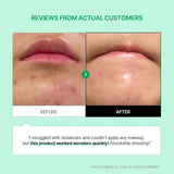 [BEST] Cicamanu 92 Serum (1.01 fl. oz. / 30ml)