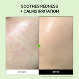 Panthenol Heartleaf Calming Pad