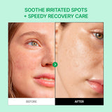 Cicamanu Clear Patch