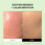 Panthenol 5.78 Heartleaf Calming Serum