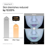 Niacinamide Rice Brightening Gel Mask (5ea)