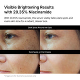 Niacinamide 20.35 Rice Brightening Serum (1.01 fl. oz. / 30ml)
